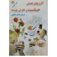 کتاب آلرژیهای فصلی , حساسیت و خارش پوست