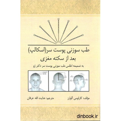 کتاب طب سوزنی پوست سر ( اسکالپ ) بعد از سکته مغزی
