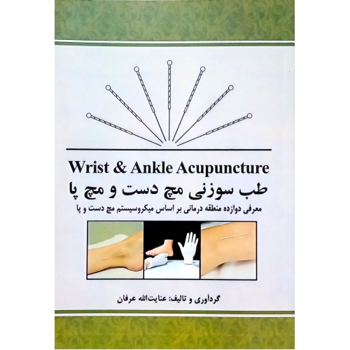 کتاب طب سوزنی مچ دست و مچ پا